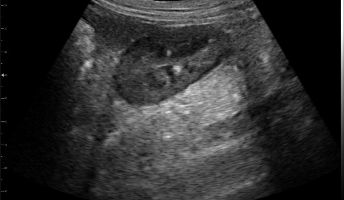 dog_kidney_in_2Dd_mode