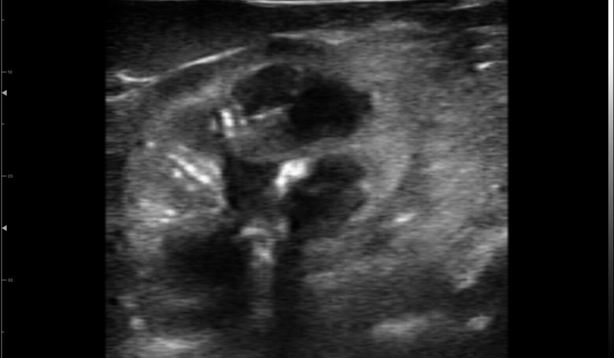 dog_kidney_in_2d_mode