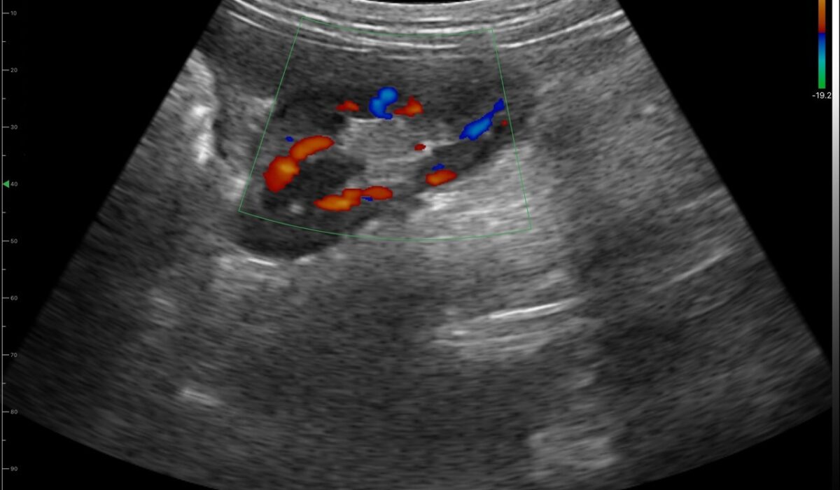 dog_kidney_in_color_mode