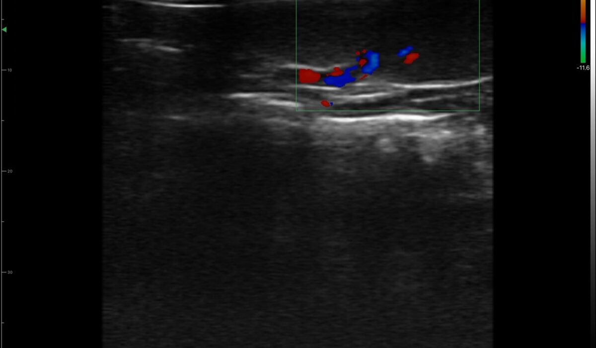 dog_spleen_in_color_mode